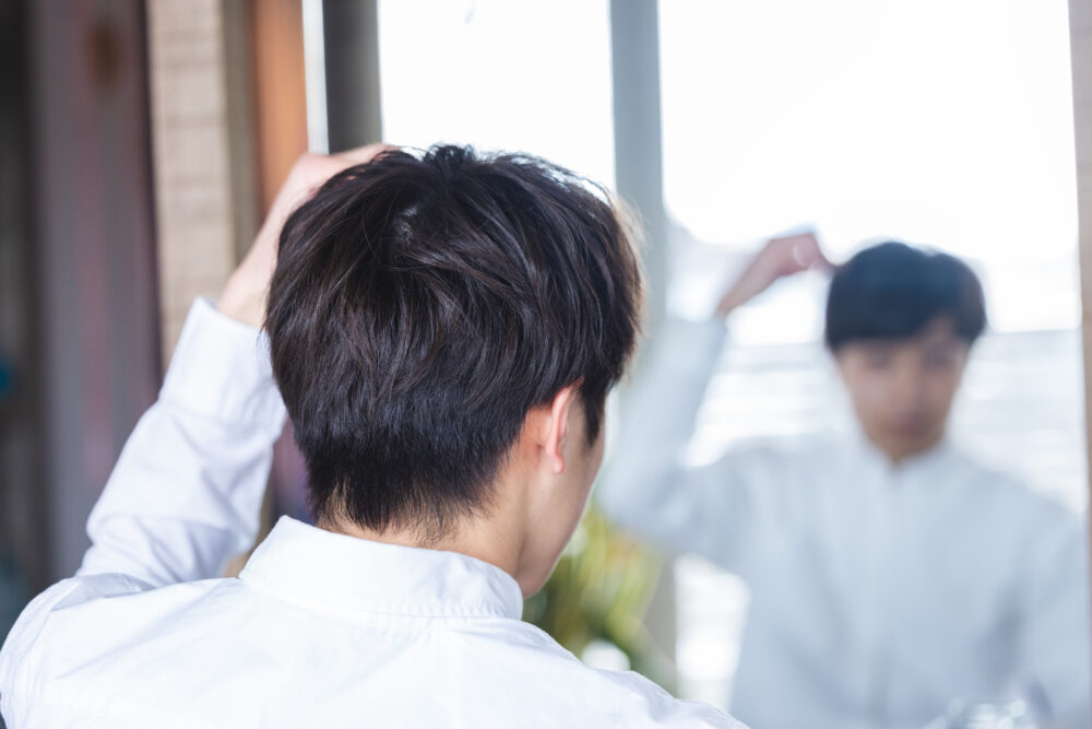 AGA（男性型脱毛症）とは