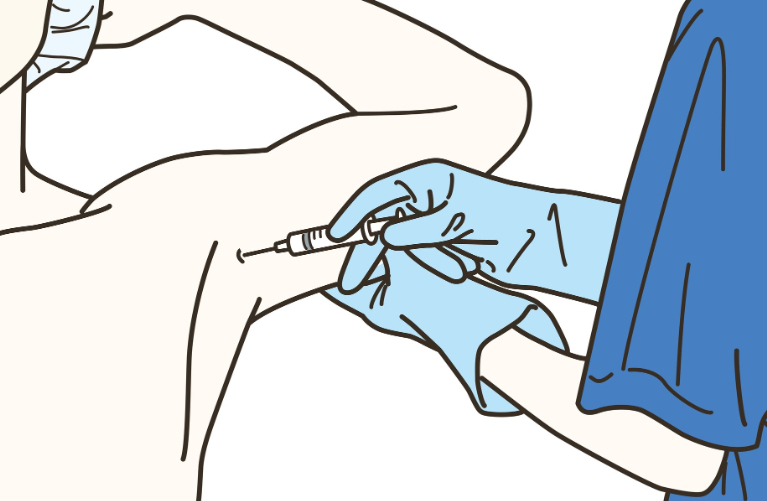 保険適用で「わき汗のボトックス治療」が受けられます